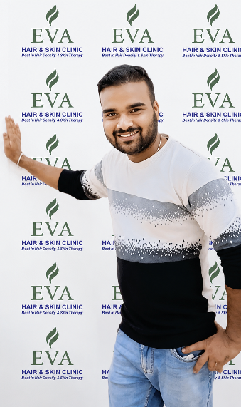 After hair transplant result 2
